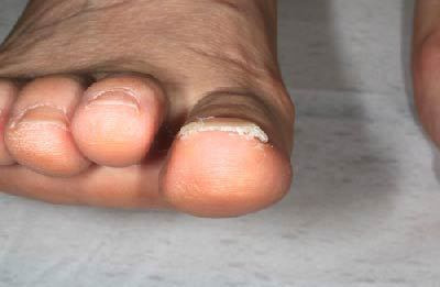 治療後 2週間後にワイヤーを外して終了となりました。