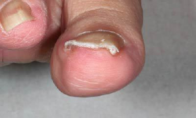 治療後 2週間後にワイヤーを外して終了となりました。