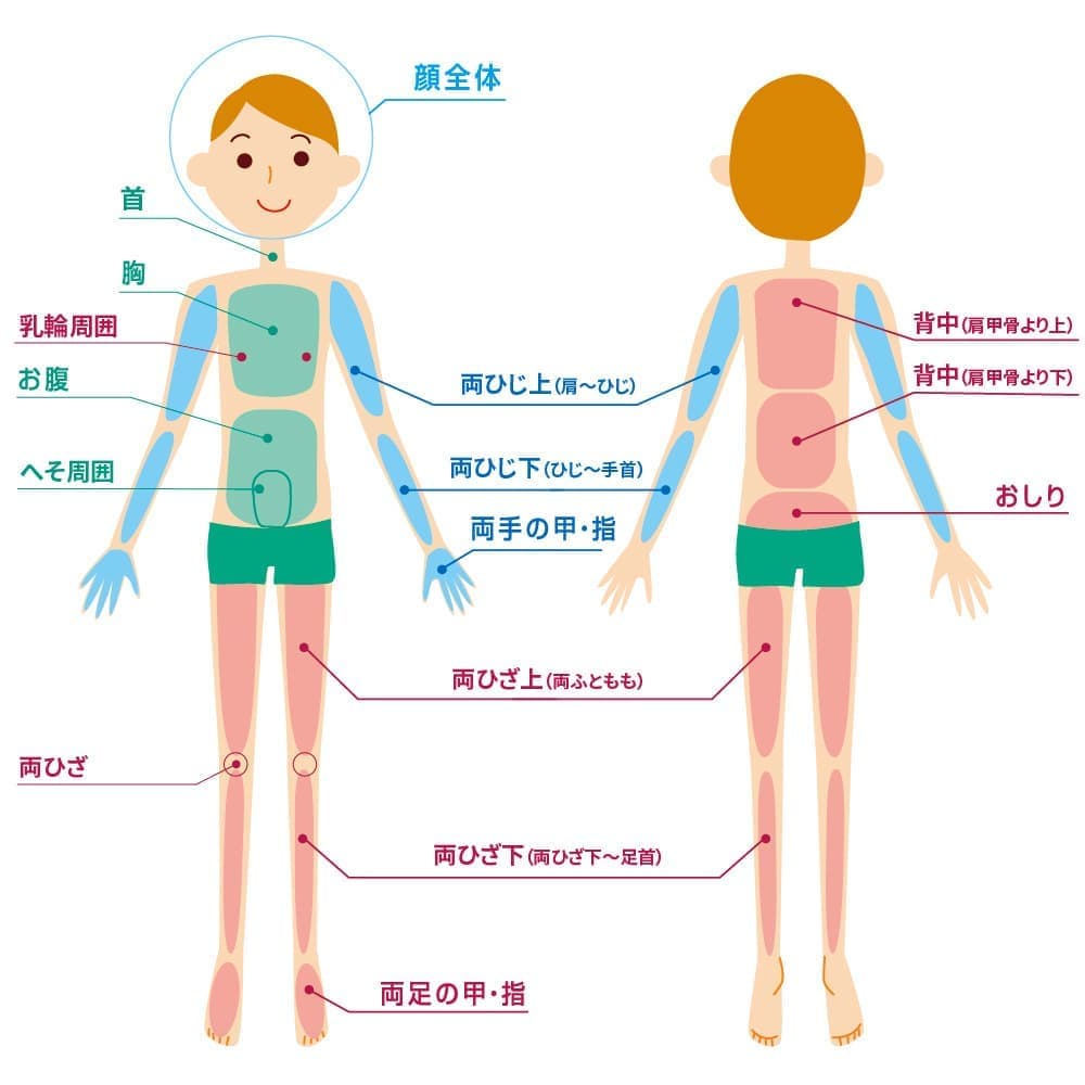 男性脱毛全体図